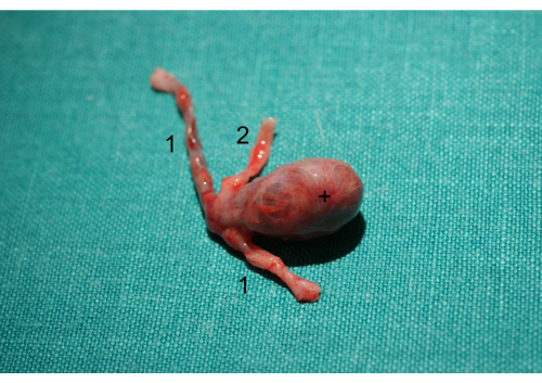 figure-results-1 Embryo development; numbered embryo diagram; focus on limb and head growth stages.