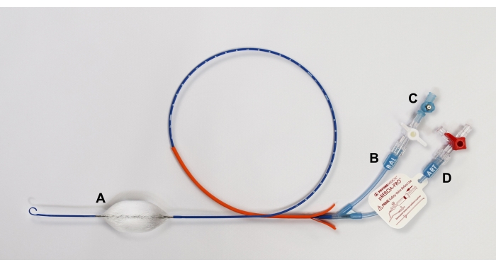 figure-results-2 Schéma du cathéter à ballonnet, utilisé en angioplastie, montrant le mécanisme de gonflage et les connexions des tubes.