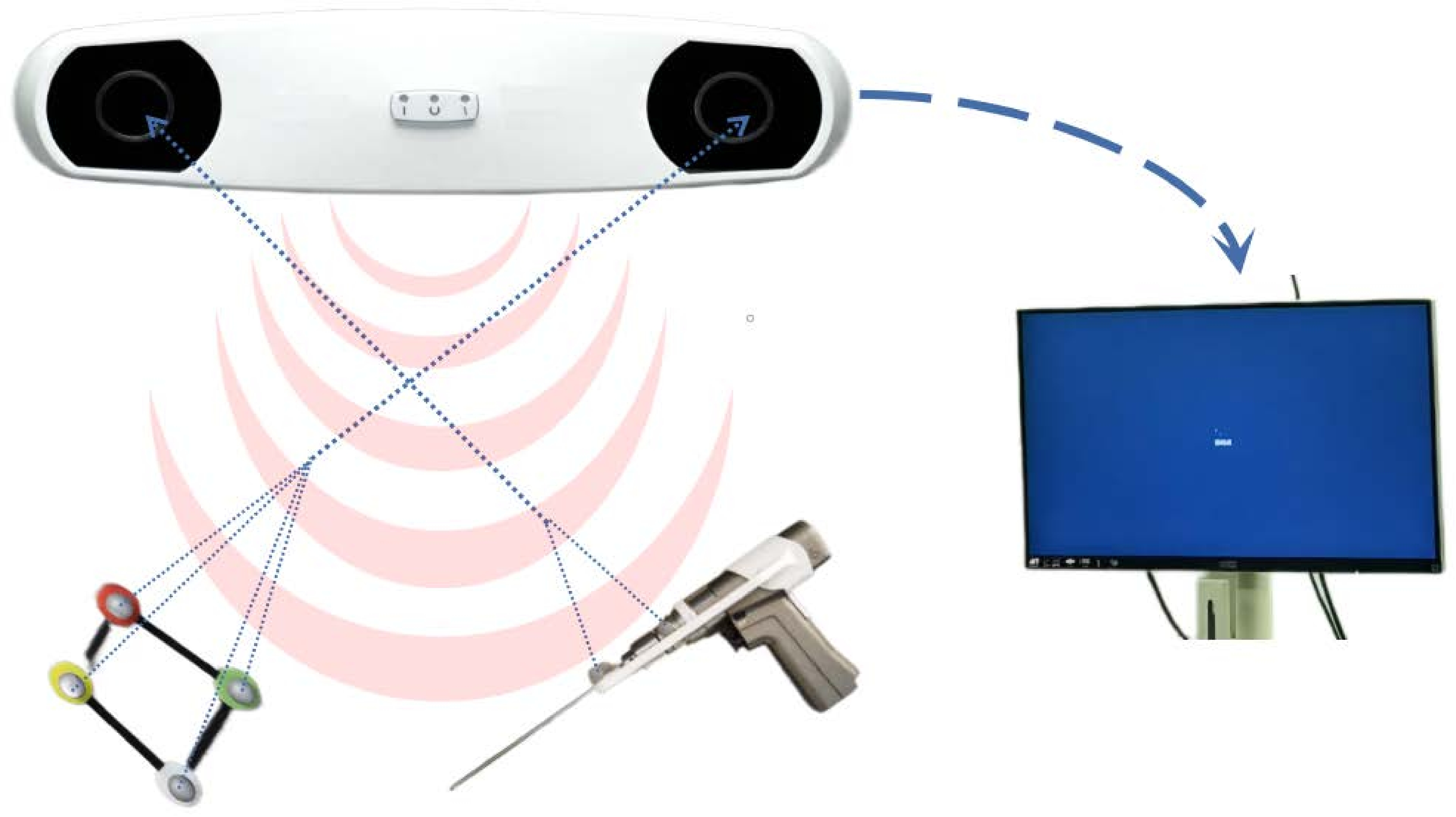 Augmented Reality Navigation-Guided Core Decompression for ...
