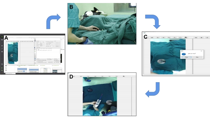 Augmented Reality Navigation-Guided Core Decompression for ...