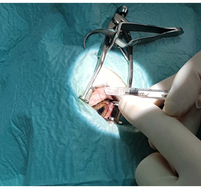 figure-protocol-3 Surgical procedure with retractors and syringe in sterile environment, highlighting operational setup.