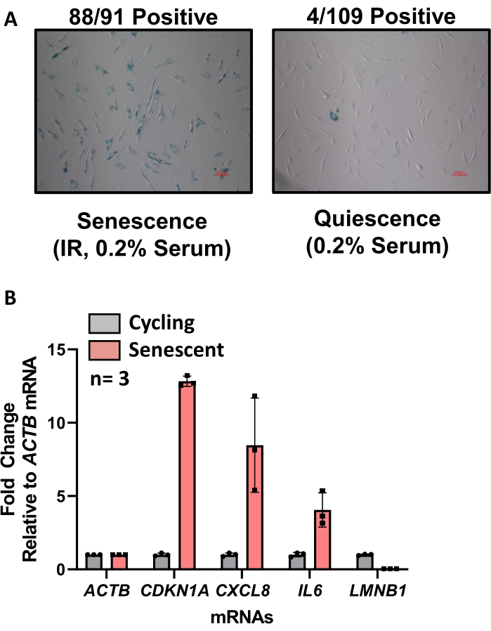 figure-results-4 Cell senescence microscopy and mRNA expression bar chart, showing senescence versus quiescence.