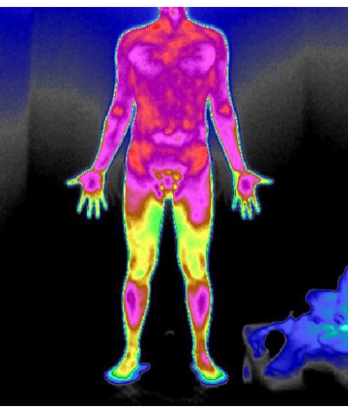 figure-results-2 Thermal imaging scan; body heat distribution; scientific analysis; infrared thermography.