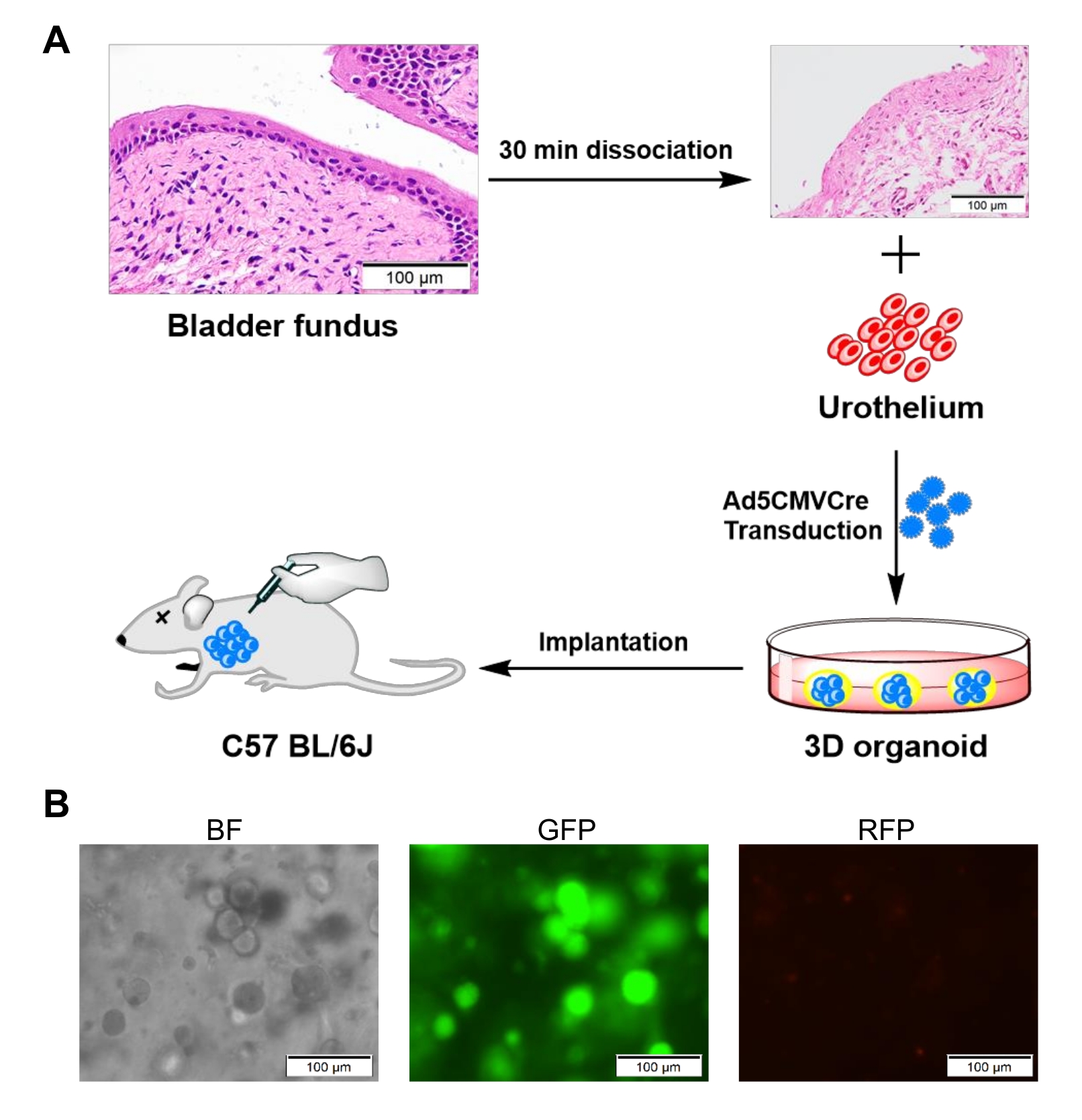 Video: Ex Vivo Organoid Model of Adenovirus-Cre Mediated Gene Deletions ...