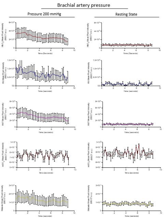 figure-results-3 Brachial artery pressure analysis, graphs show HbO2 and HHb at 200 mmHg vs. resting, data comparison.