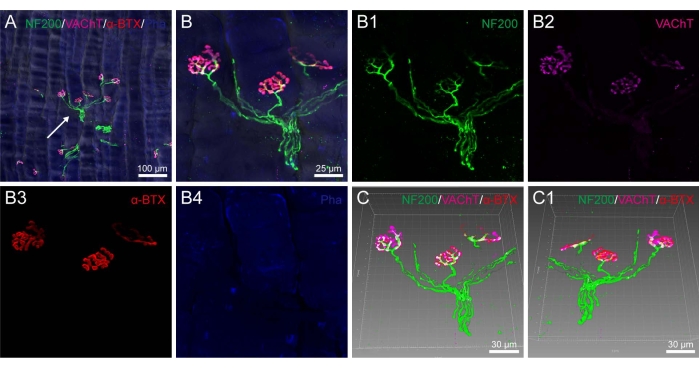 Neuromuscular junction analysis; NF200, VAChT, α-BTX labels; confocal microscopy, fluorescence.