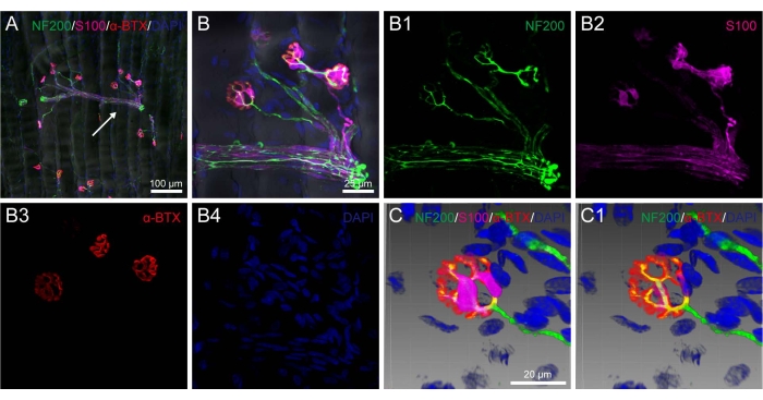 Fluorescence microscopy of neuromuscular junctions; NF200, S100, α-BTX markers; multi-panel diagram.
