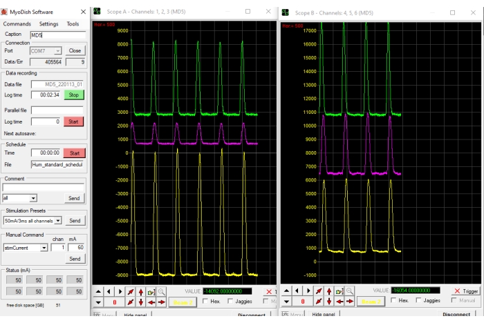 figure-results-3 Electrophysiology data graph, showing electrical signal monitoring using MyoDish software interface.