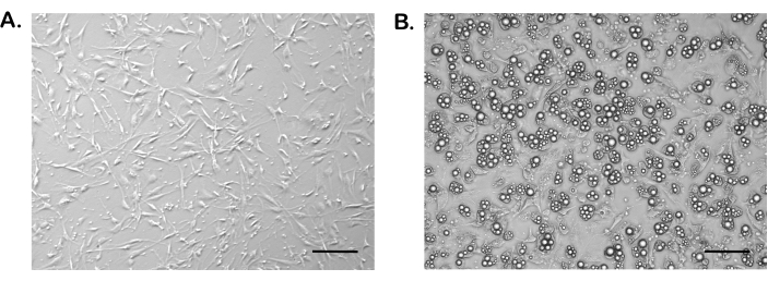 Differentiated Mouse Adipocytes in Primary Culture: A Model of Insulin ...