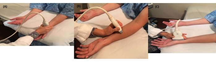 Ultrasound imaging process of arm evaluation; diagnostic method; sequence of probe positions.