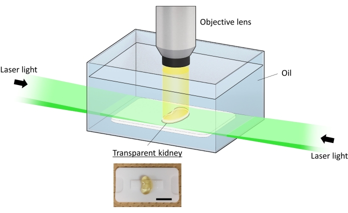 figure-results-3 Laser light chromatography setup diagram with optical lens and transparent kidney sample analysis.
