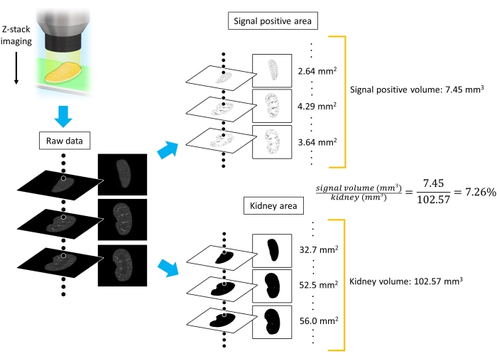 figure-results-5 Z-stack imaging diagram; kidney signal analysis; includes raw data layers, volume calculation results.