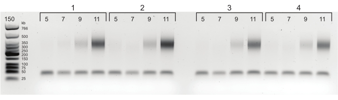 DNA electrophoresis result, gel bands indicating size separation, molecular ladder visible on left.