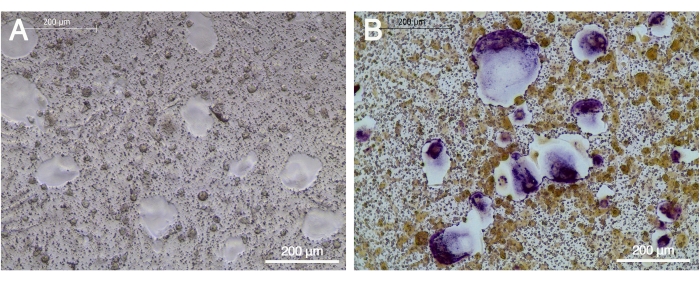 figure-results-2 Microscope image of tissue comparison, stained versus unstained sections at 200 μm scale for analysis.