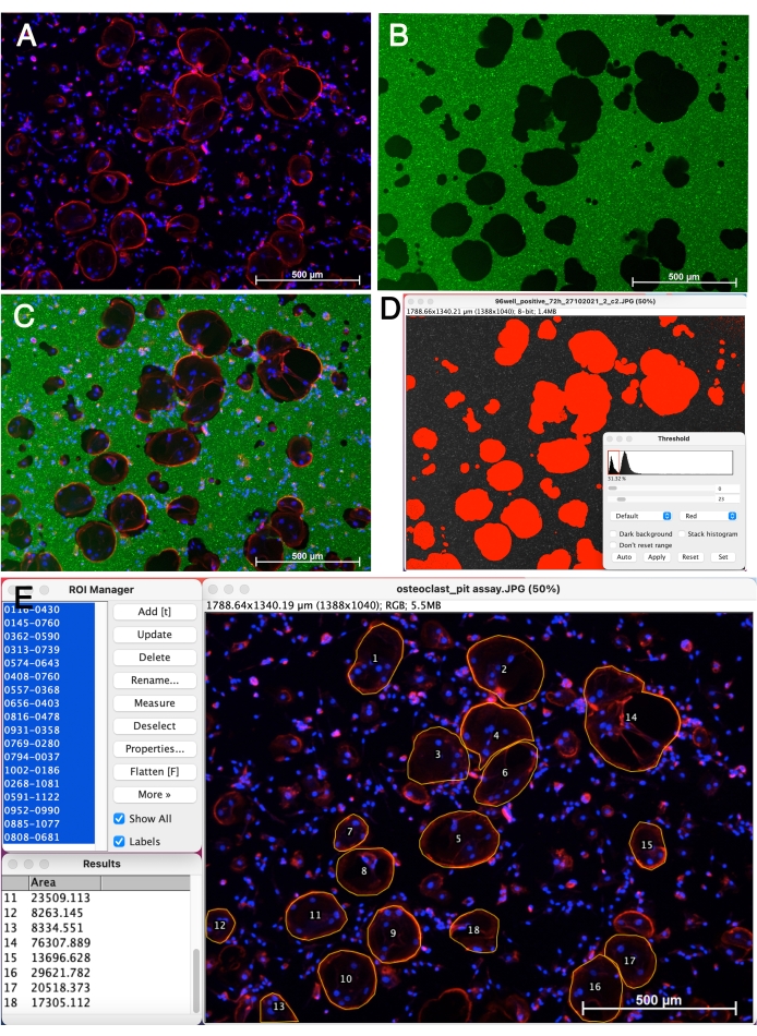 figure-results-3 Osteoclast pit assay; microscopy image; cell analysis; bone resorption study; data quantification.