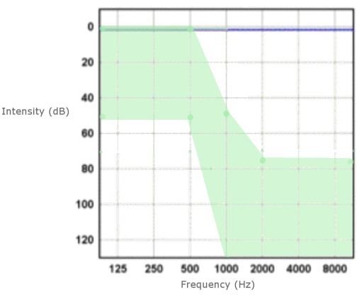 chart of frequency response showing intensity in dB across 125-8000 Hz for acoustic analysis