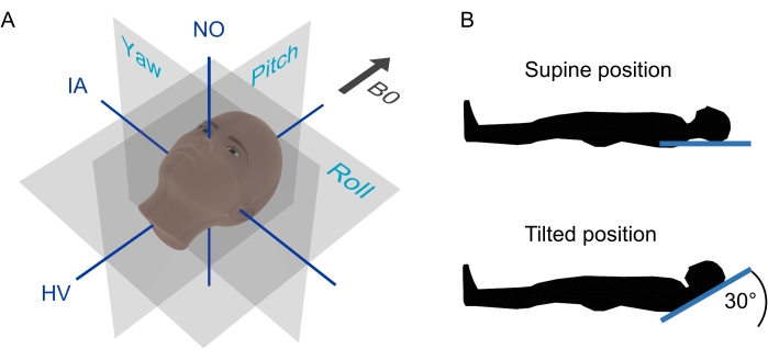 figure-introduction-1 Head rotation axes diagram; positioning for supine and tilted postures, shows direction and angles.