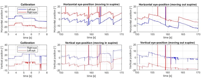 Eye position tracking graphs; horizontal/vertical movement; calibration and positional changes.