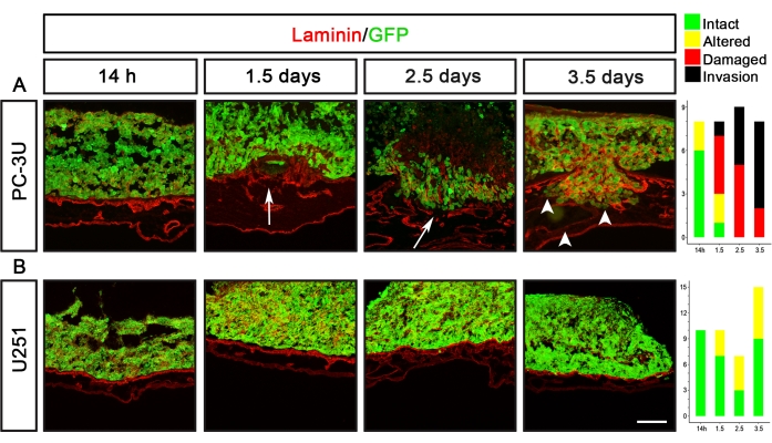 Laminin/GFP fluorescence in tumor invasion microscopy image; PC-3U vs U251; invasion analysis chart.