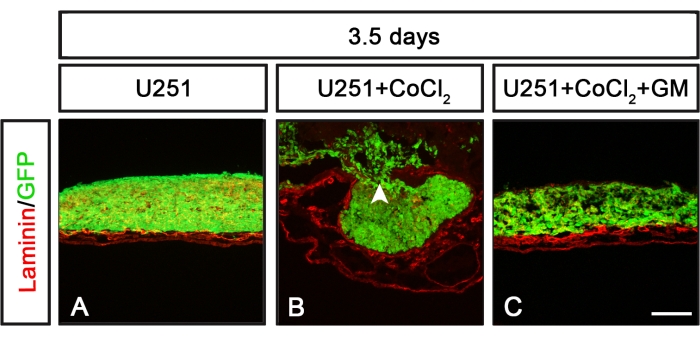 Laminin/GFP expression in U251 cells, fluorescence microscopy results show CoCl2 and GM effects.