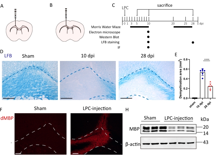figure-results-1 LPC-induced demyelination experiment; includes timeline, LFB staining, IF, Western Blot analysis.