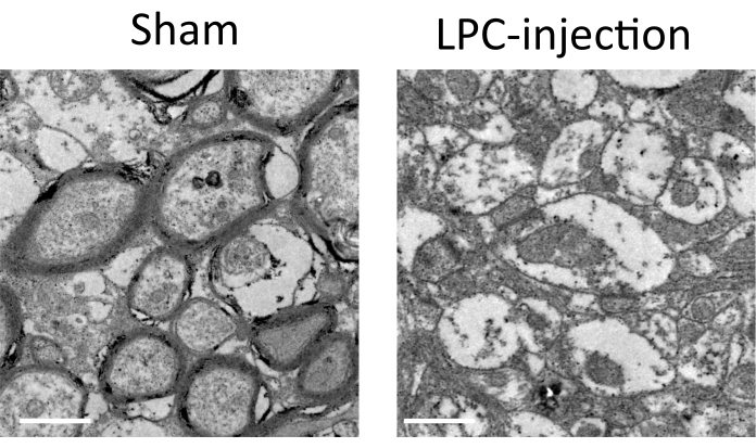 figure-results-2 Electron microscopy comparison of nerve tissues; sham vs LPC-injection; cellular structure analysis.