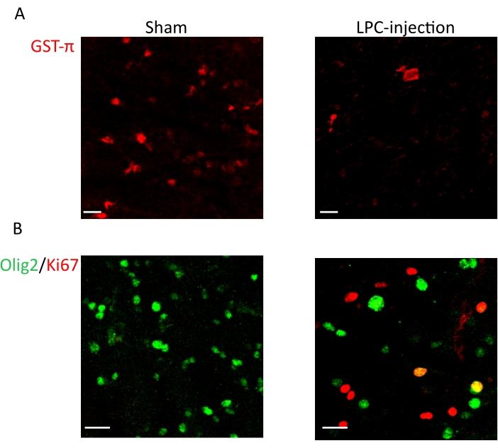 figure-results-3 Fluorescence microscopy results; GST-π, Olig2/Ki67 markers; Sham vs. LPC-injection comparison.