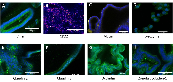 Immunofluorescence microscopy images of proteins: villin, CDX2, mucin, lysozyme, claudin, occludin.