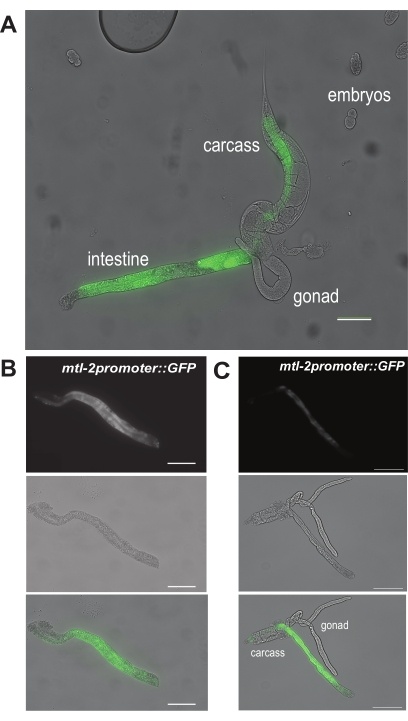 figure-results-6 Fluorescence microscopy of C. elegans with GFP expression highlighting intestine and gonad structures.