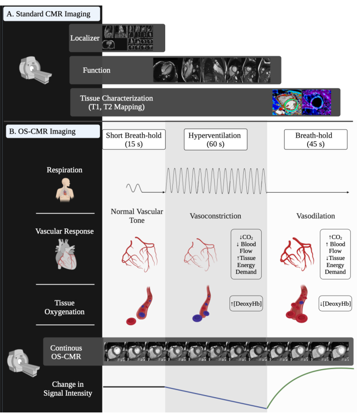 Cardiac MRI process; diagram shows CMR imaging phases, vascular response to breath control, hyperventilation.