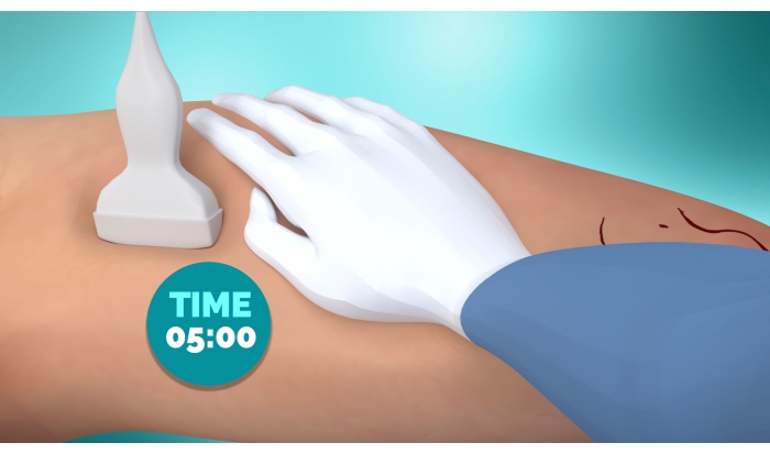Ultrasound application process diagram showing time in medical detection method.
