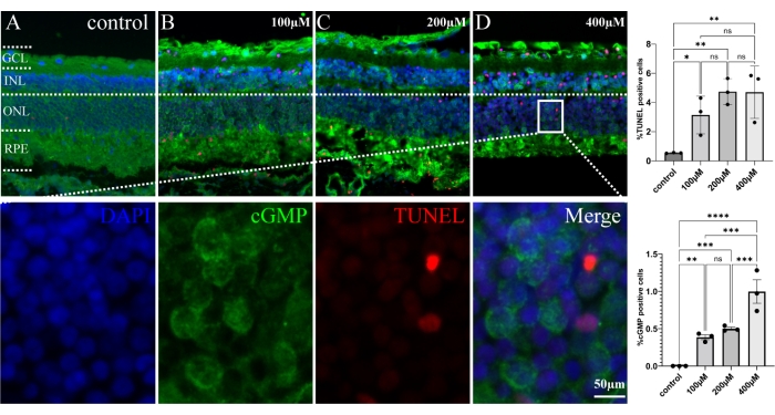 Retinal cell apoptosis analysis, immunofluorescence images, TUNEL assay, and statistical graphs.