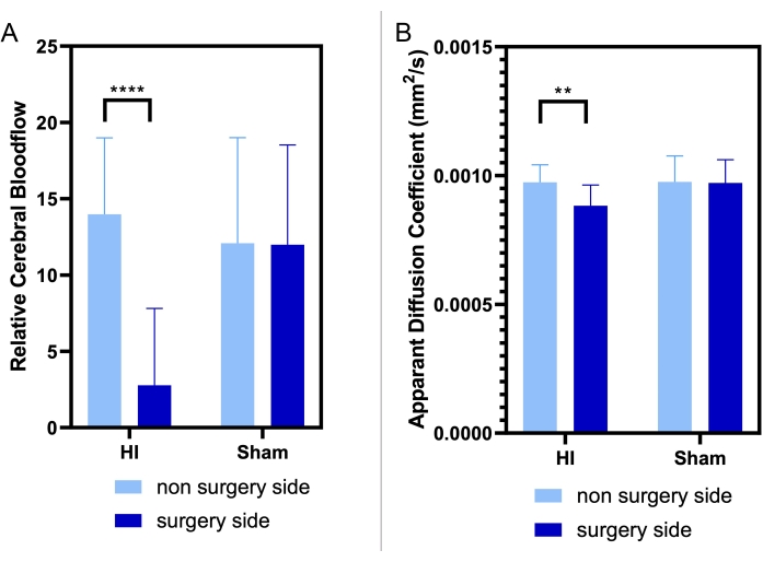 Cerebral blood flow and diffusion coefficient bar graph; HI vs. Sham; surgical impact analysis.