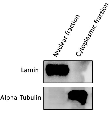 Western blot analysis, lamin, alpha-tubulin, nuclear vs cytoplasmic fraction, protein separation.