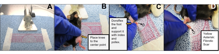Rodent surgery setup sequence; steps for knee positioning, dorsiflexion, and fibrotic scar identification.