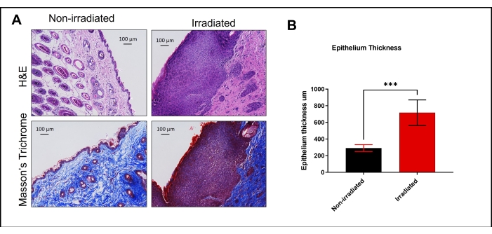 Histological comparison of irradiated vs. non-irradiated tissue, H&E and Masson's Trichrome staining, epithelium thickness analysis chart.
