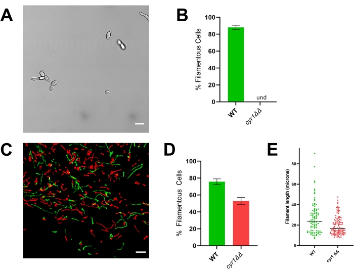 figure-results-4 Filamentous cell analysis: microscopy image, bar chart data, fluorescence microscopy, graph results.