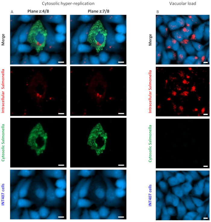 figure-results-1 Cytosolic hyper-replication and vacuolar load microscopy of Salmonella in INT407 cells.