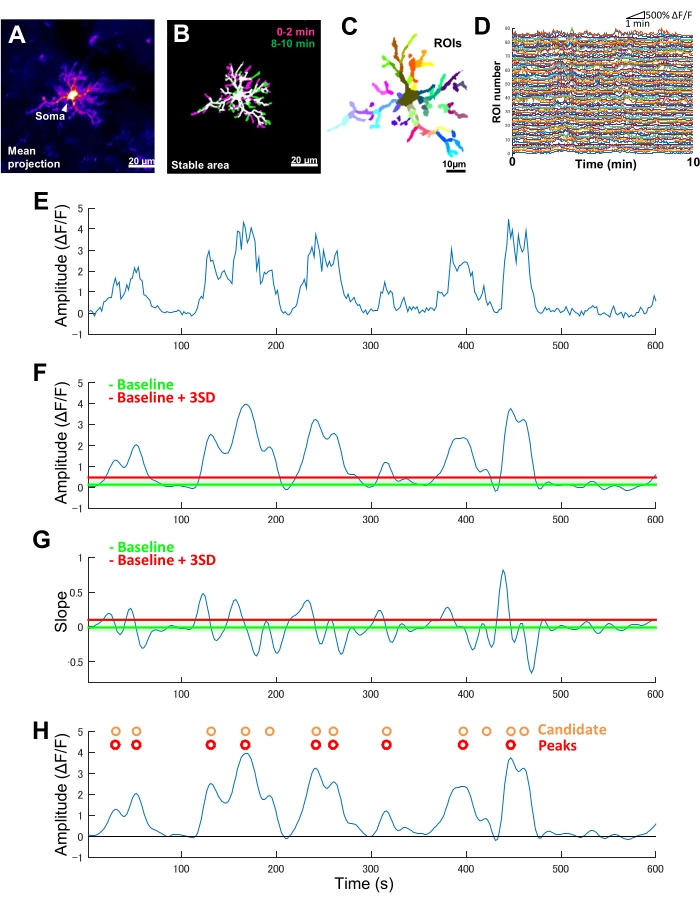 Neuronal activity analysis, fluorescence imaging, ROI mapping, amplitude and slope graphs, peak detection.
