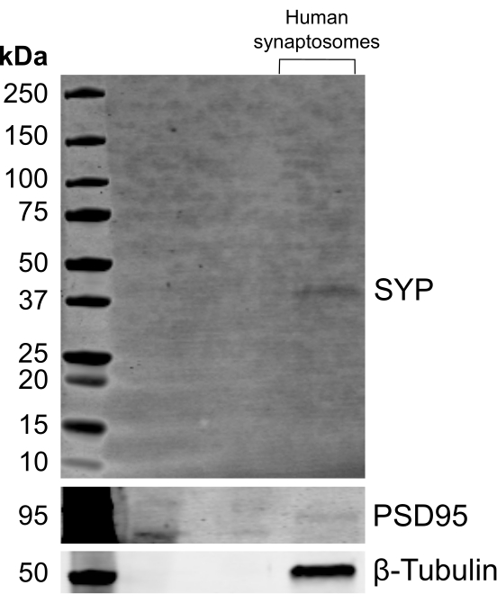 Protein analysis via Western blot, PSD95, SYP, β-Tubulin detection in human synaptosomes.