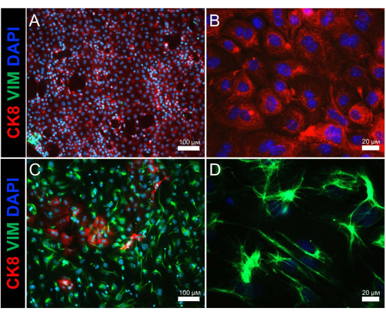 figure-results-2 Fluorescence microscopy image; CK8, VIM, DAPI staining; cellular protein expression; comparative analysis.