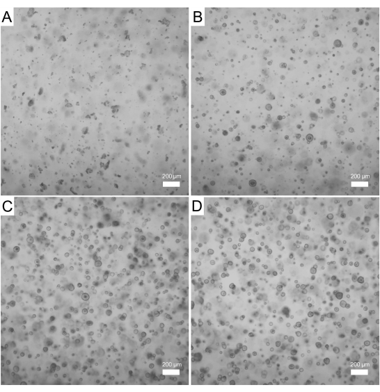figure-results-3 Microscopic image of cell density variations in a petri dish, panel comparison A-D, 200μm scale.