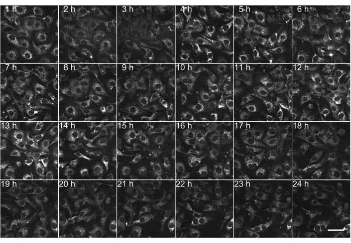 figure-results-4 Time-lapse microscopy, cell division, 1-24h progression, fluorescence imaging, biological study.