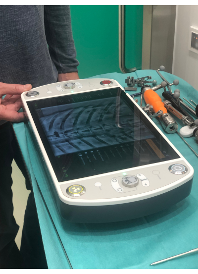 Portable X-ray device on surgical table analyzing chest X-ray; medical imaging equipment setup.