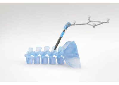 Robotic spinal surgery setup diagram; precision, alignment, vertebrae, medical technology.