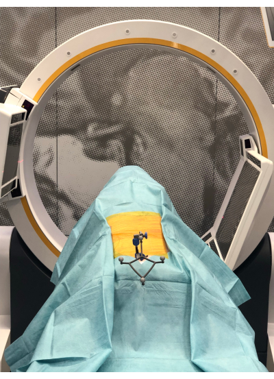 Surgical imaging setup with C-arm scanner for real-time intraoperative visualization.