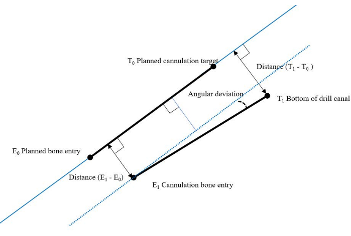 Static equilibrium diagram; angular deviation, bone cannulation concept, vector distances, orthopedic study.