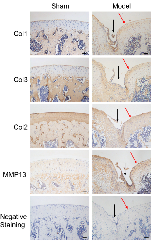 Histological analysis of protein markers Col1, Col3, Col2, MMP13; sham vs. model; staining results.