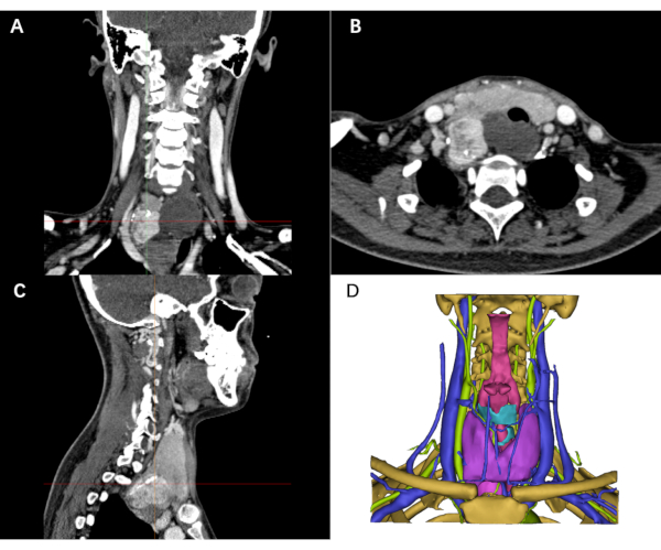 figure-results-5 CT scan images in anatomical planes for medical analysis; includes coronal, axial, sagittal views.