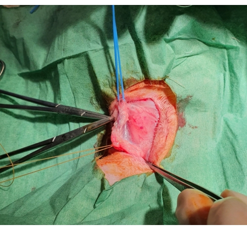 figure-results-1 Surgical procedure, incision and suture technique, medical operation, wound closure demonstration.